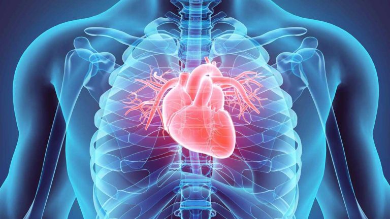 scompenso cardiaco