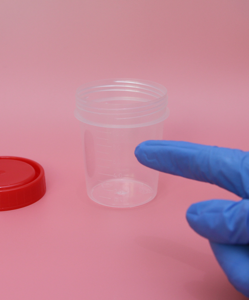 test delle urine