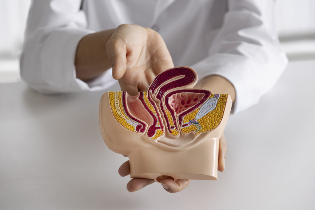 tumore del colon