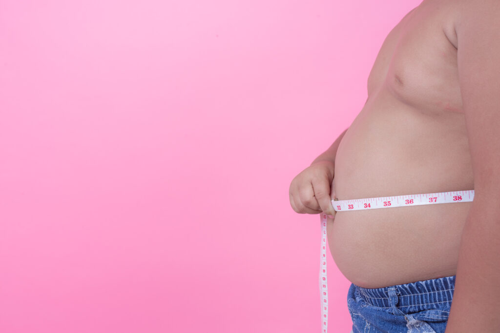 obesità, malattia cronica , stile di vita 