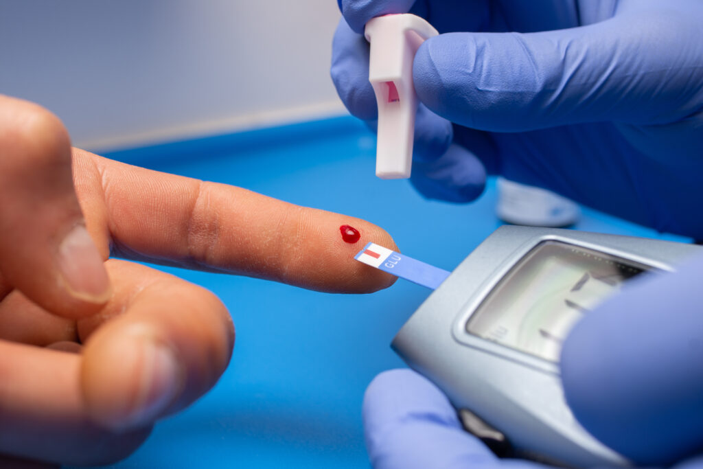 diabete, idrogeli, insulina, pancreas, trapianti