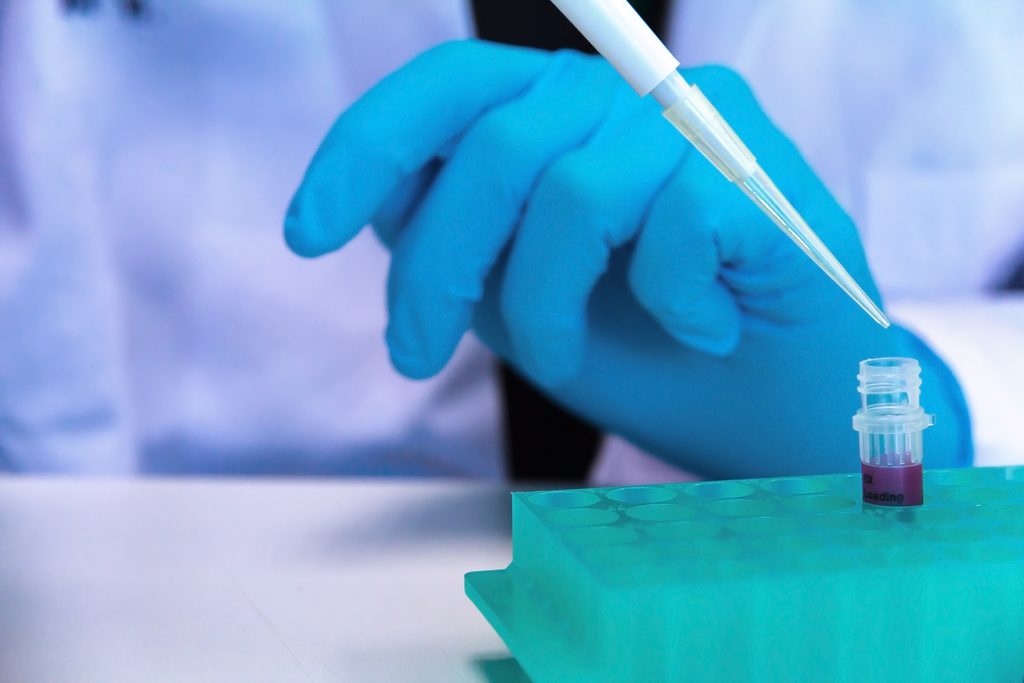 biopsie liquide, dna circolante, tumori, neoplasie, diagnosi oncologica, prevenzione, diagnosi precoce